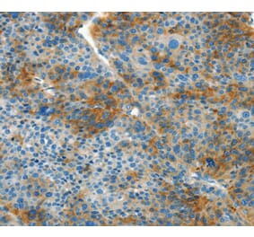 Immunohistochemistry - L1CAM Antibody from Signalway Antibody (37403) - Antibodies.com