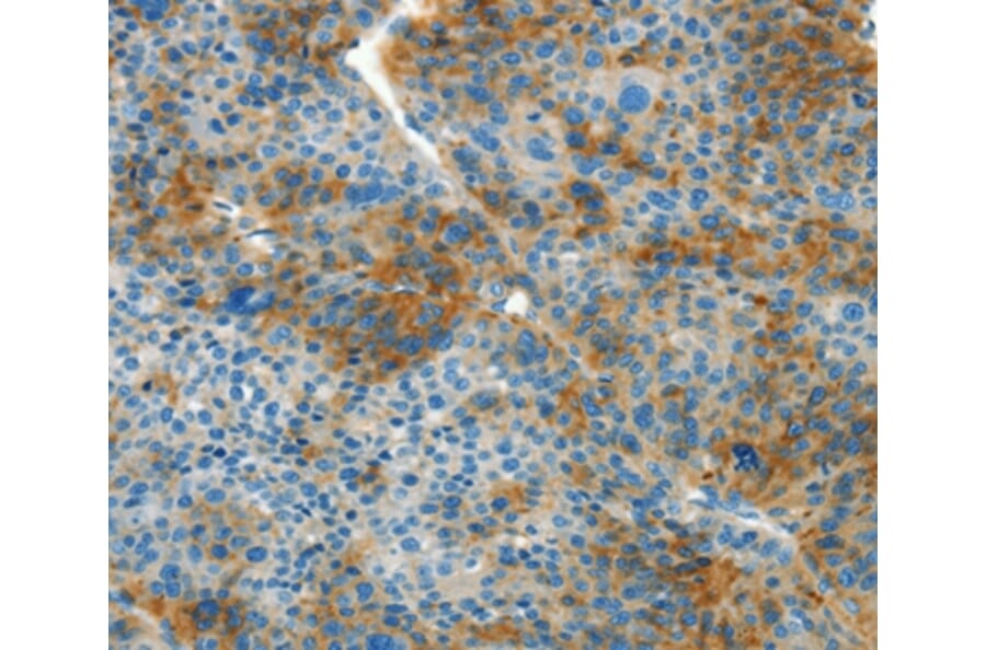 Immunohistochemistry - L1CAM Antibody from Signalway Antibody (37403) - Antibodies.com