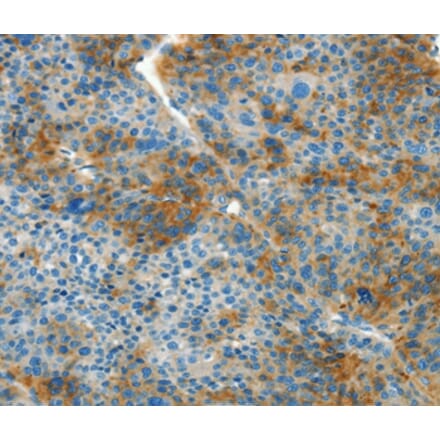 Immunohistochemistry - L1CAM Antibody from Signalway Antibody (37403) - Antibodies.com