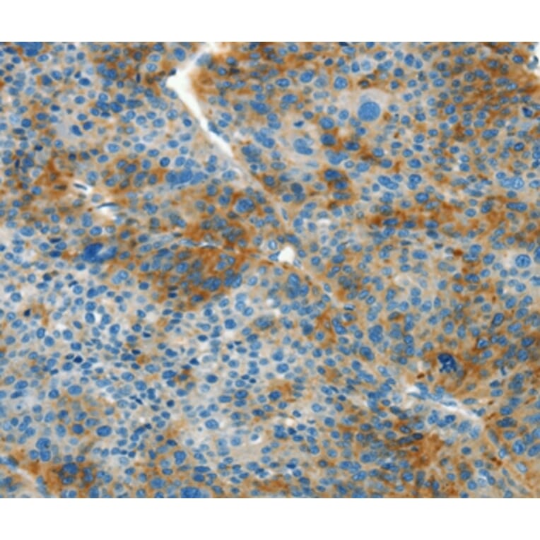 Immunohistochemistry - L1CAM Antibody from Signalway Antibody (37403) - Antibodies.com