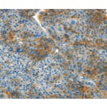 Immunohistochemistry - L1CAM Antibody from Signalway Antibody (37403) - Antibodies.com