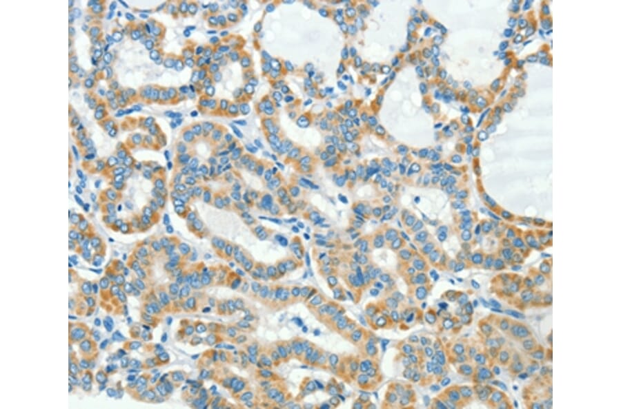 Immunohistochemistry - L1CAM Antibody from Signalway Antibody (37403) - Antibodies.com