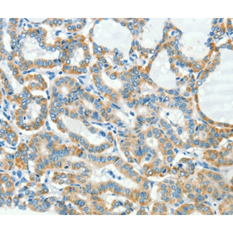 Immunohistochemistry - L1CAM Antibody from Signalway Antibody (37403) - Antibodies.com