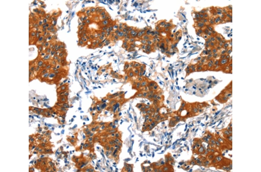 Immunohistochemistry - HTR3B Antibody from Signalway Antibody (37405) - Antibodies.com