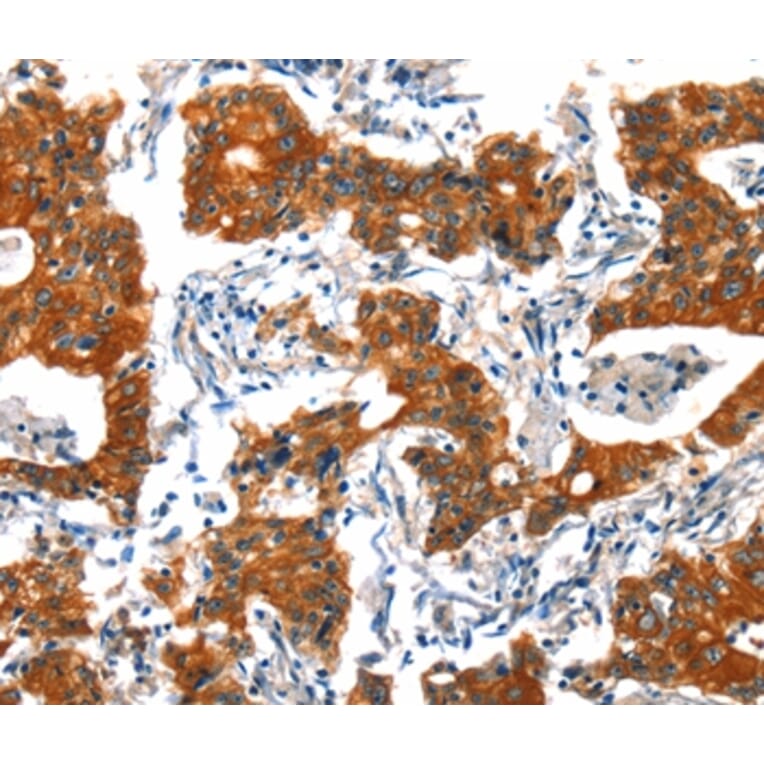 Immunohistochemistry - HTR3B Antibody from Signalway Antibody (37405) - Antibodies.com