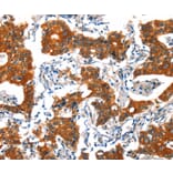 Immunohistochemistry - HTR3B Antibody from Signalway Antibody (37405) - Antibodies.com