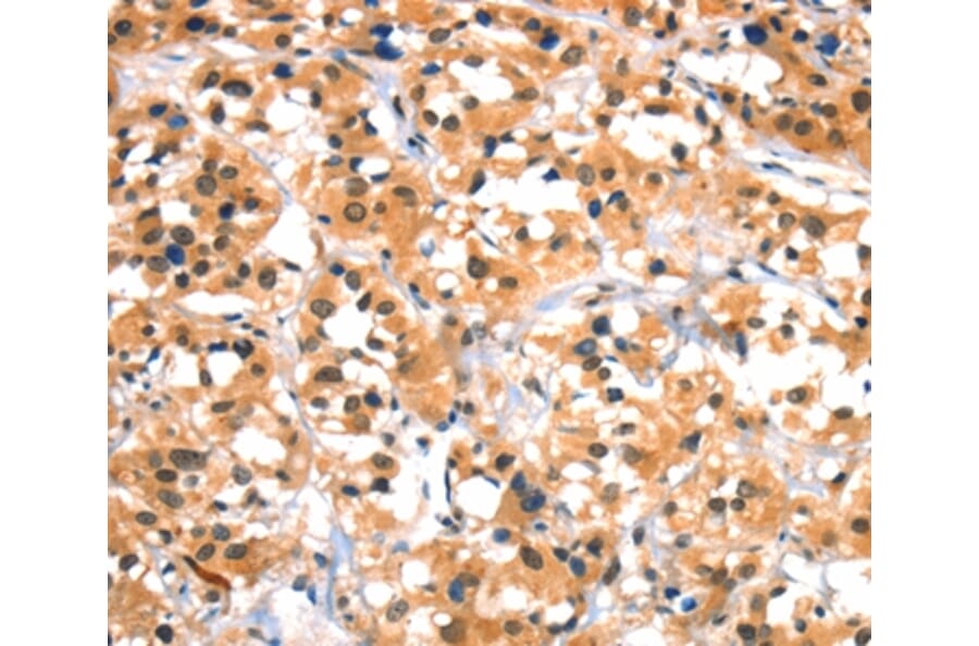 Immunohistochemistry - HTR3B Antibody from Signalway Antibody (37405) - Antibodies.com
