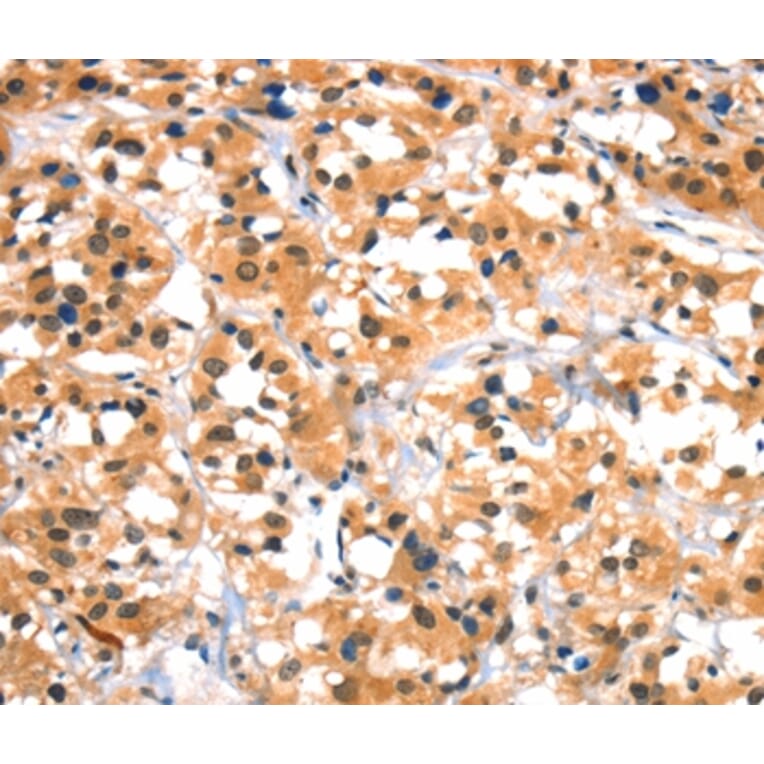 Immunohistochemistry - HTR3B Antibody from Signalway Antibody (37405) - Antibodies.com