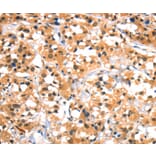 Immunohistochemistry - HTR3B Antibody from Signalway Antibody (37405) - Antibodies.com