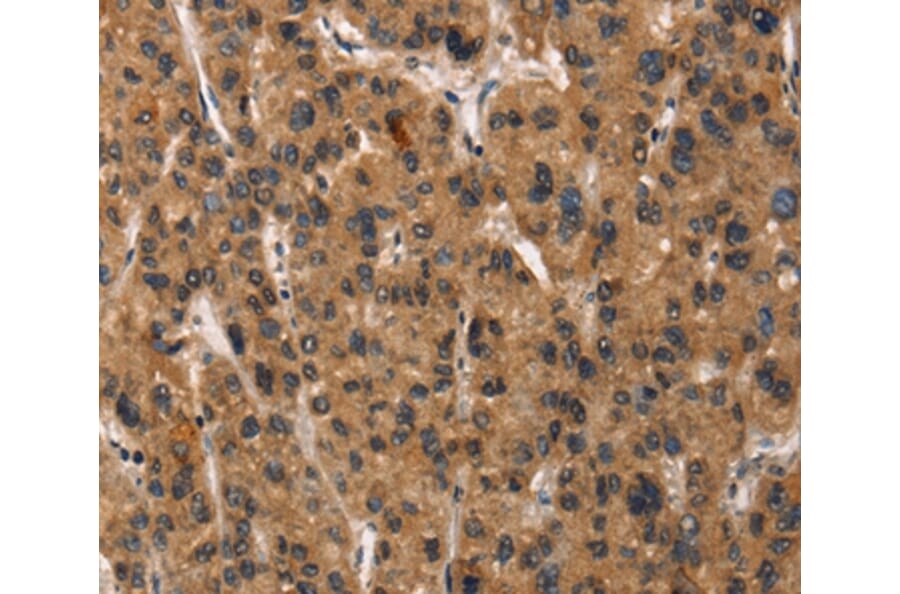 Immunohistochemistry - DEFA5 Antibody from Signalway Antibody (37411) - Antibodies.com