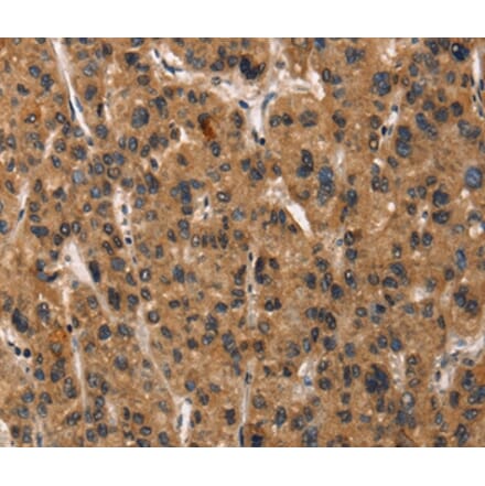 Immunohistochemistry - DEFA5 Antibody from Signalway Antibody (37411) - Antibodies.com