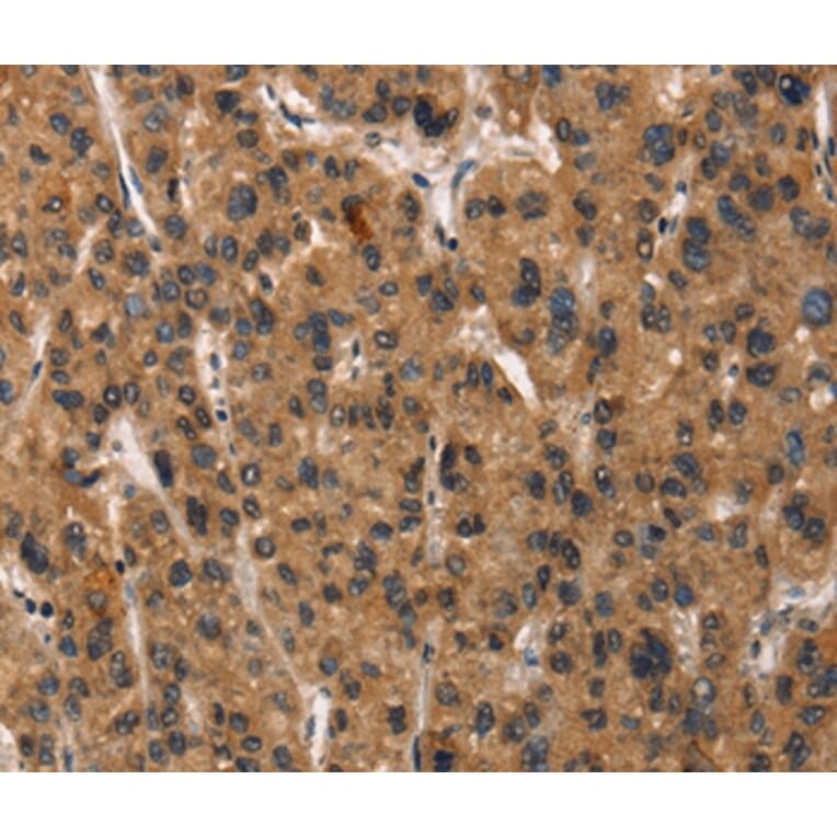 Immunohistochemistry - DEFA5 Antibody from Signalway Antibody (37411) - Antibodies.com