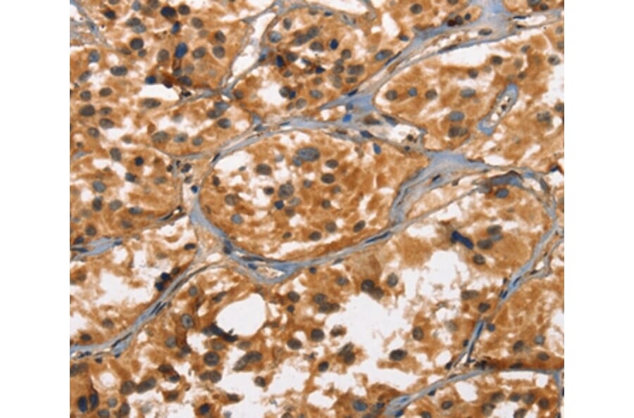 Immunohistochemistry - DEFA5 Antibody from Signalway Antibody (37411) - Antibodies.com