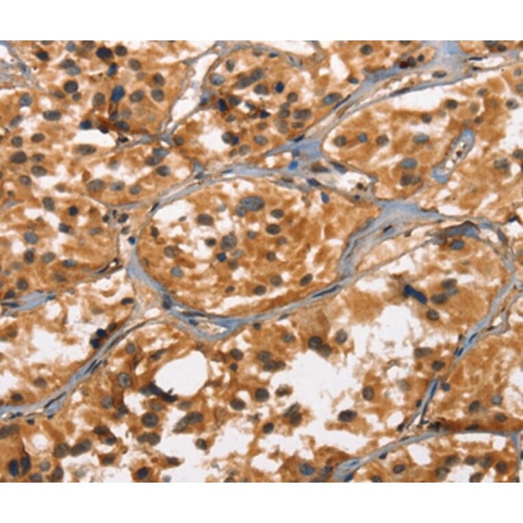 Immunohistochemistry - DEFA5 Antibody from Signalway Antibody (37411) - Antibodies.com