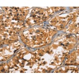 Immunohistochemistry - DEFA5 Antibody from Signalway Antibody (37411) - Antibodies.com