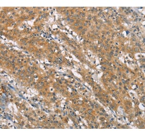 Immunohistochemistry - NLRP7 Antibody from Signalway Antibody (37421) - Antibodies.com