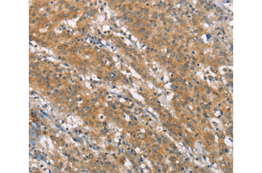 Immunohistochemistry - NLRP7 Antibody from Signalway Antibody (37421) - Antibodies.com
