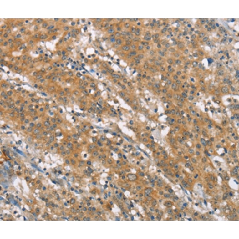 Immunohistochemistry - NLRP7 Antibody from Signalway Antibody (37421) - Antibodies.com