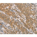 Immunohistochemistry - NLRP7 Antibody from Signalway Antibody (37421) - Antibodies.com
