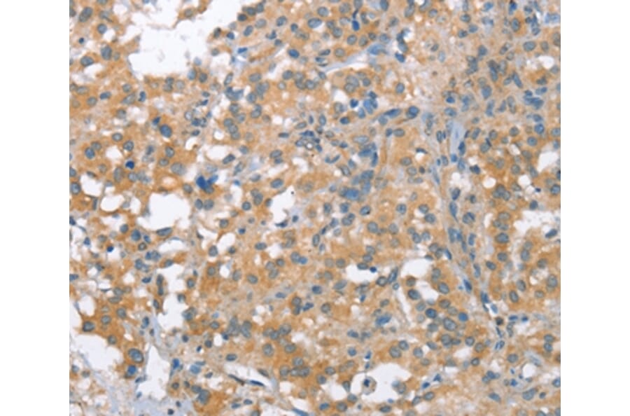 Immunohistochemistry - NLRP7 Antibody from Signalway Antibody (37421) - Antibodies.com