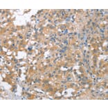Immunohistochemistry - NLRP7 Antibody from Signalway Antibody (37421) - Antibodies.com