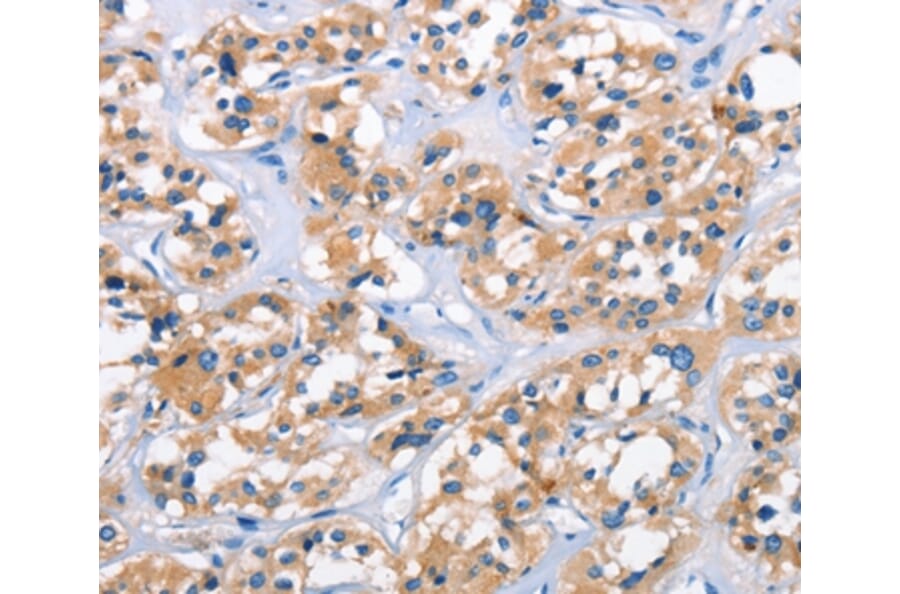 Immunohistochemistry - APOL6 Antibody from Signalway Antibody (37425) - Antibodies.com