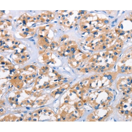 Immunohistochemistry - APOL6 Antibody from Signalway Antibody (37425) - Antibodies.com