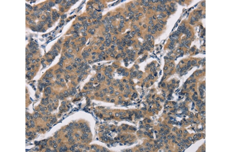 Immunohistochemistry - SH2B2 Antibody from Signalway Antibody (37426) - Antibodies.com