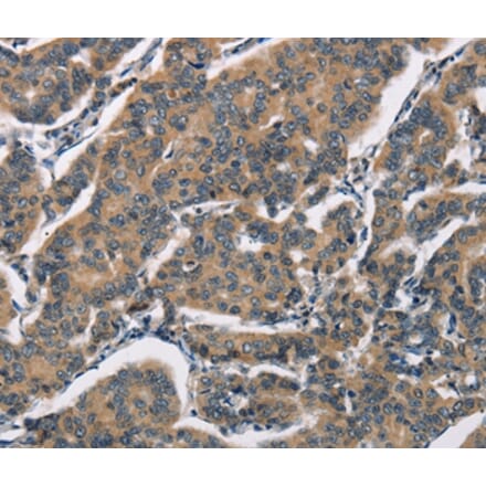 Immunohistochemistry - SH2B2 Antibody from Signalway Antibody (37426) - Antibodies.com