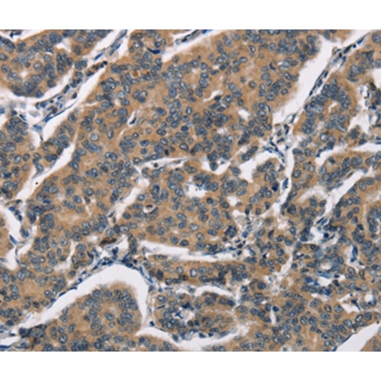 Immunohistochemistry - SH2B2 Antibody from Signalway Antibody (37426) - Antibodies.com