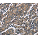 Immunohistochemistry - SH2B2 Antibody from Signalway Antibody (37426) - Antibodies.com