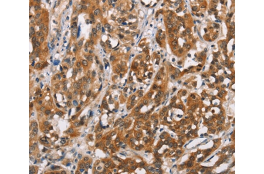Immunohistochemistry - SH2B2 Antibody from Signalway Antibody (37426) - Antibodies.com