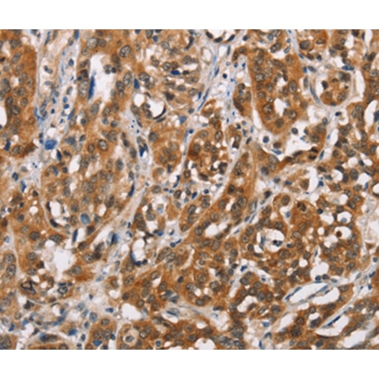 Immunohistochemistry - SH2B2 Antibody from Signalway Antibody (37426) - Antibodies.com
