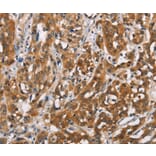 Immunohistochemistry - SH2B2 Antibody from Signalway Antibody (37426) - Antibodies.com