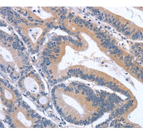 Immunohistochemistry - GDF11 Antibody from Signalway Antibody (37444) - Antibodies.com