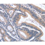 Immunohistochemistry - GDF11 Antibody from Signalway Antibody (37444) - Antibodies.com