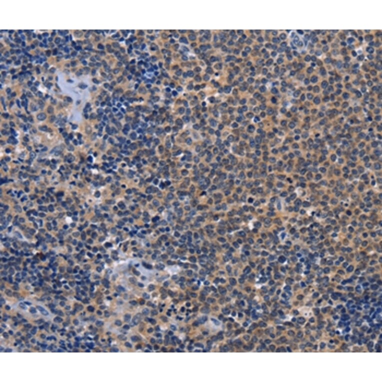Immunohistochemistry - GDF11 Antibody from Signalway Antibody (37444) - Antibodies.com