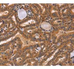 Immunohistochemistry - CCL23 Antibody from Signalway Antibody (37465) - Antibodies.com
