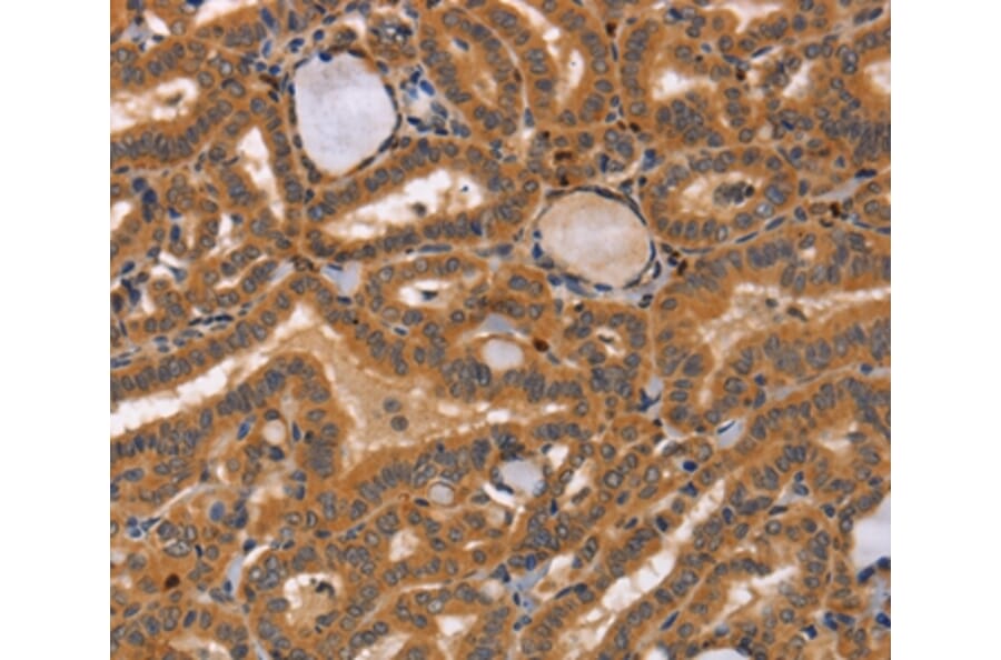 Immunohistochemistry - CCL23 Antibody from Signalway Antibody (37465) - Antibodies.com