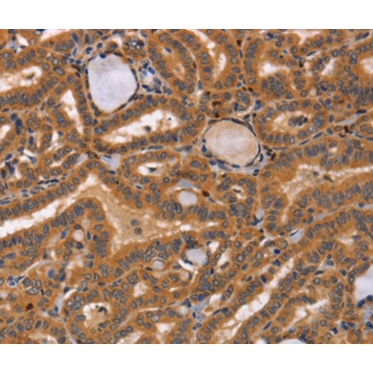 Immunohistochemistry - CCL23 Antibody from Signalway Antibody (37465) - Antibodies.com