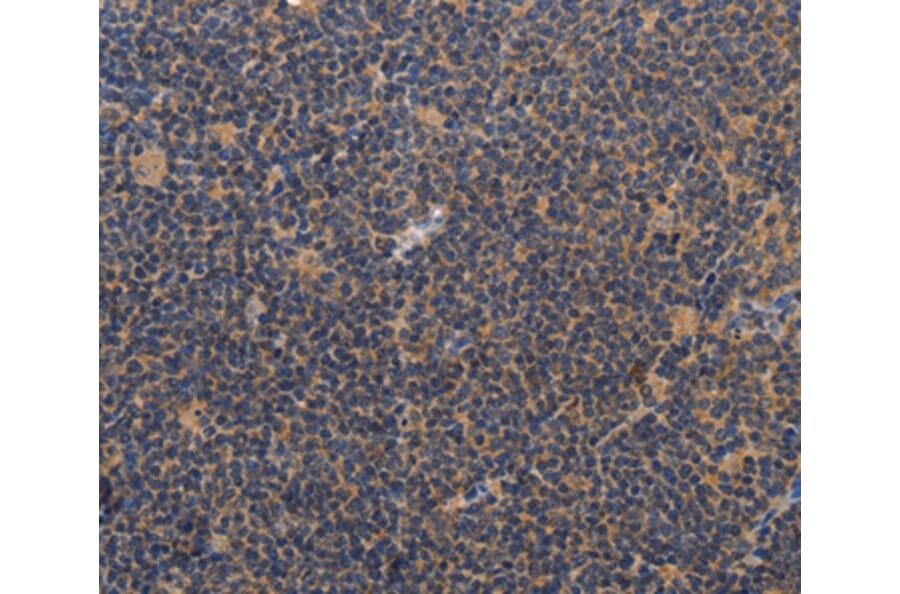 Immunohistochemistry - CCL23 Antibody from Signalway Antibody (37465) - Antibodies.com