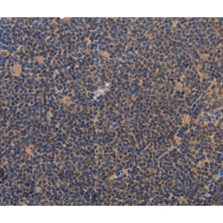 Immunohistochemistry - CCL23 Antibody from Signalway Antibody (37465) - Antibodies.com