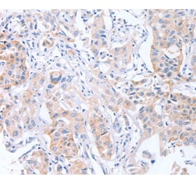 Immunohistochemistry - CDCA4 Antibody from Signalway Antibody (37481) - Antibodies.com