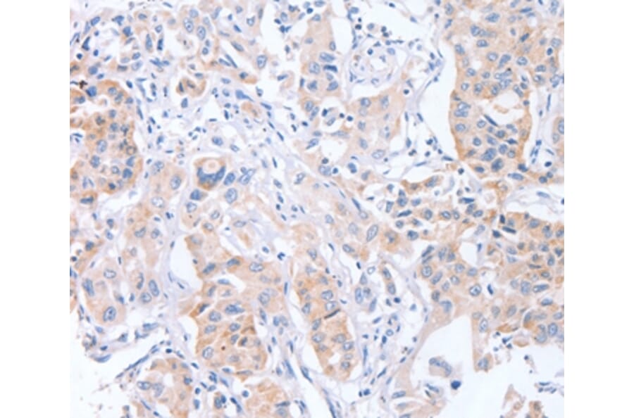 Immunohistochemistry - CDCA4 Antibody from Signalway Antibody (37481) - Antibodies.com
