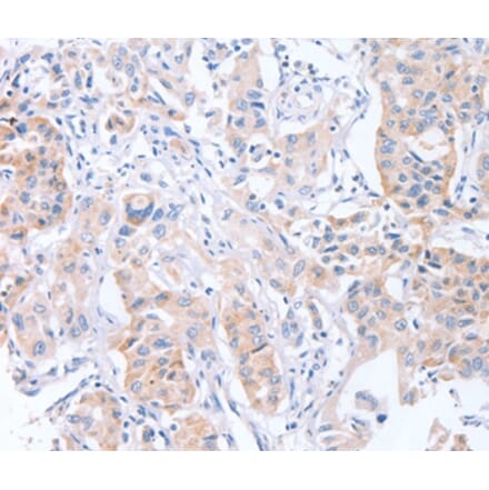 Immunohistochemistry - CDCA4 Antibody from Signalway Antibody (37481) - Antibodies.com