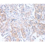 Immunohistochemistry - CDCA4 Antibody from Signalway Antibody (37481) - Antibodies.com