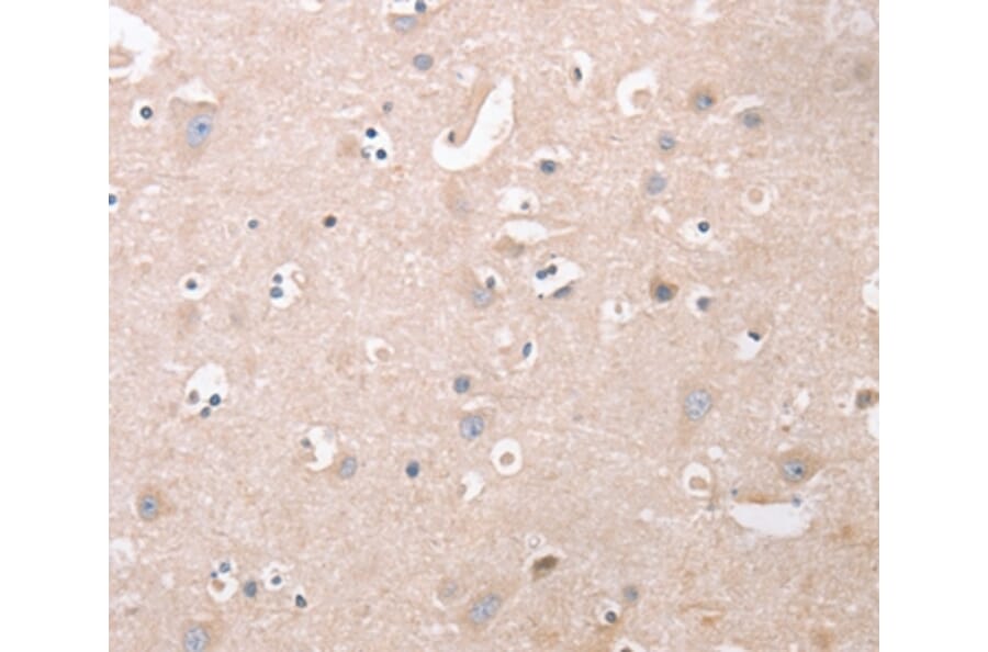 Immunohistochemistry - CDCA4 Antibody from Signalway Antibody (37481) - Antibodies.com