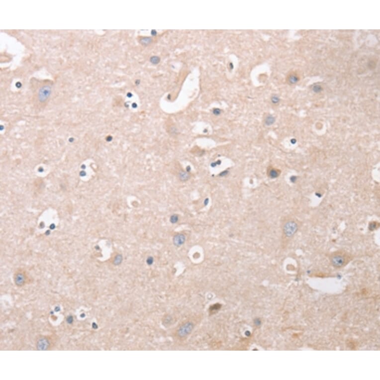 Immunohistochemistry - CDCA4 Antibody from Signalway Antibody (37481) - Antibodies.com