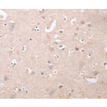 Immunohistochemistry - CDCA4 Antibody from Signalway Antibody (37481) - Antibodies.com
