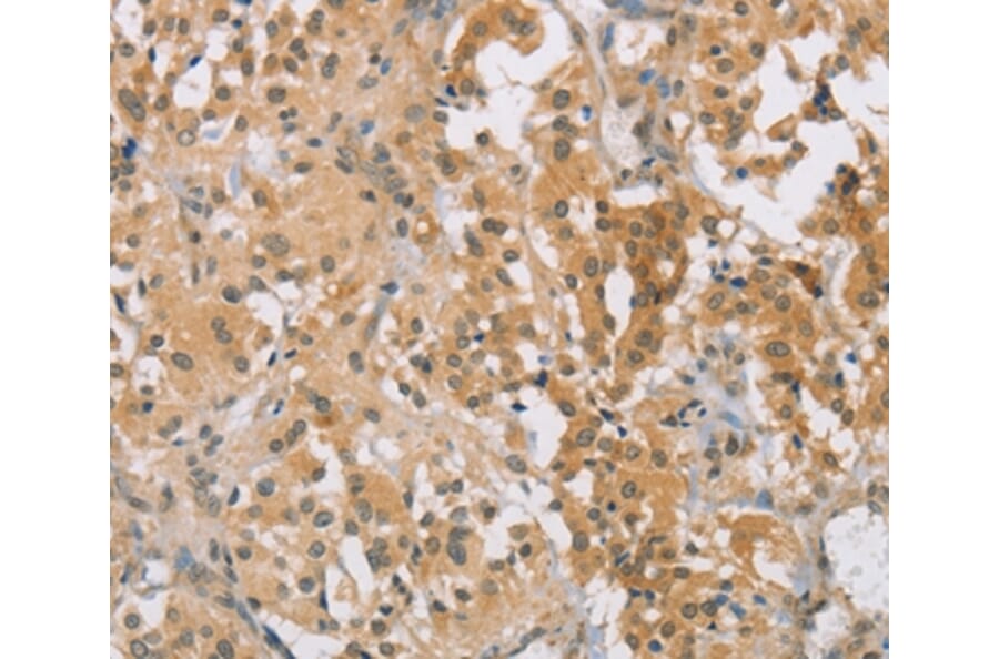 Immunohistochemistry - CENPF Antibody from Signalway Antibody (37483) - Antibodies.com